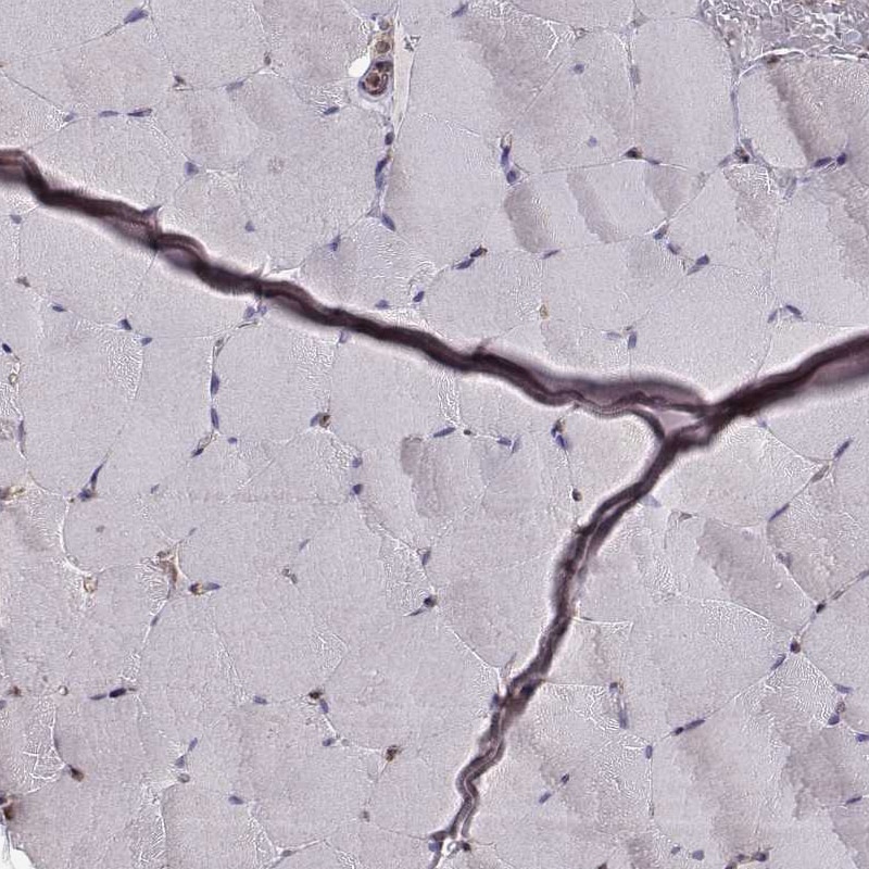 ERp57/PDIA3 Antibody (CL2444) - Azide and BSA Free Immunohistochemistry-Paraffin: ERp57/PDIA3 Antibody [NBP3-44467]