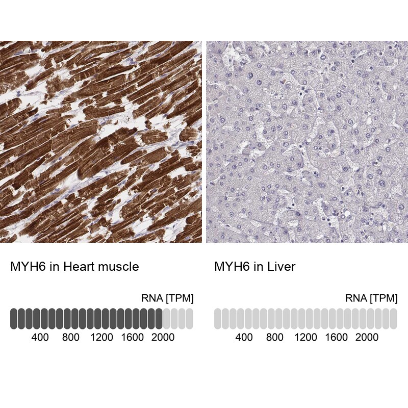 MYH6 Antibody (CL2148) - Azide and BSA Free Immunohistochemistry-Paraffin: MYH6 Antibody [NBP3-44471]