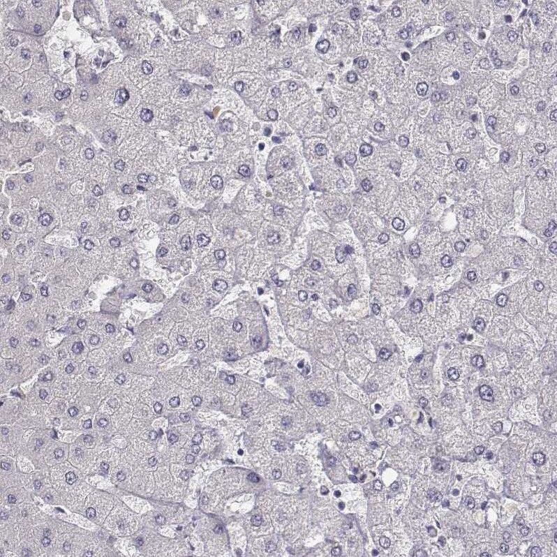 MYH6 Antibody (CL2148) - Azide and BSA Free Immunohistochemistry-Paraffin: MYH6 Antibody [NBP3-44471]