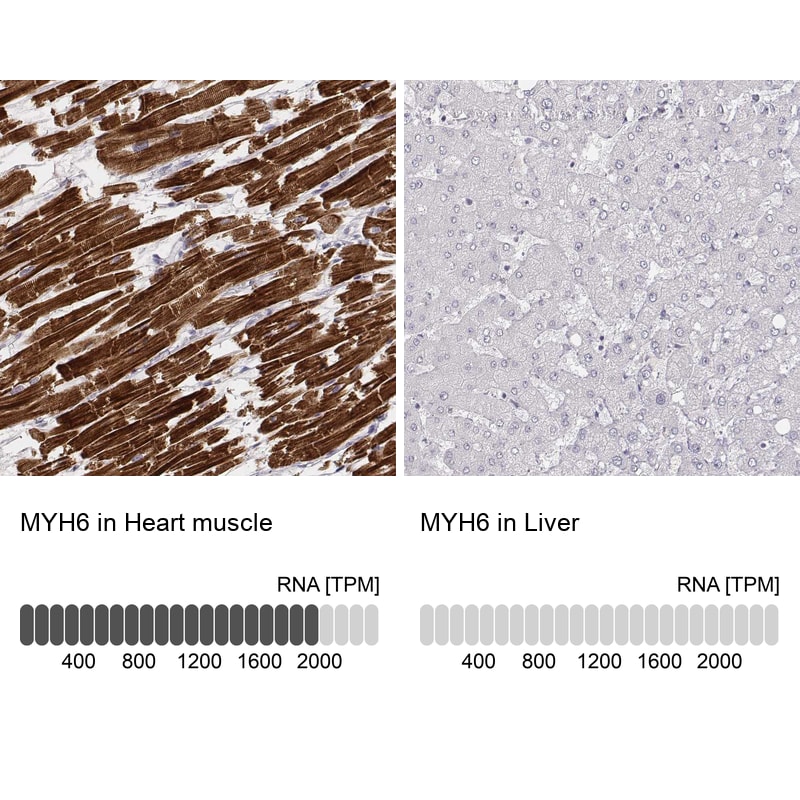 MYH6 Antibody (CL2155) - Azide and BSA Free Immunohistochemistry-Paraffin: MYH6 Antibody [NBP3-44472]