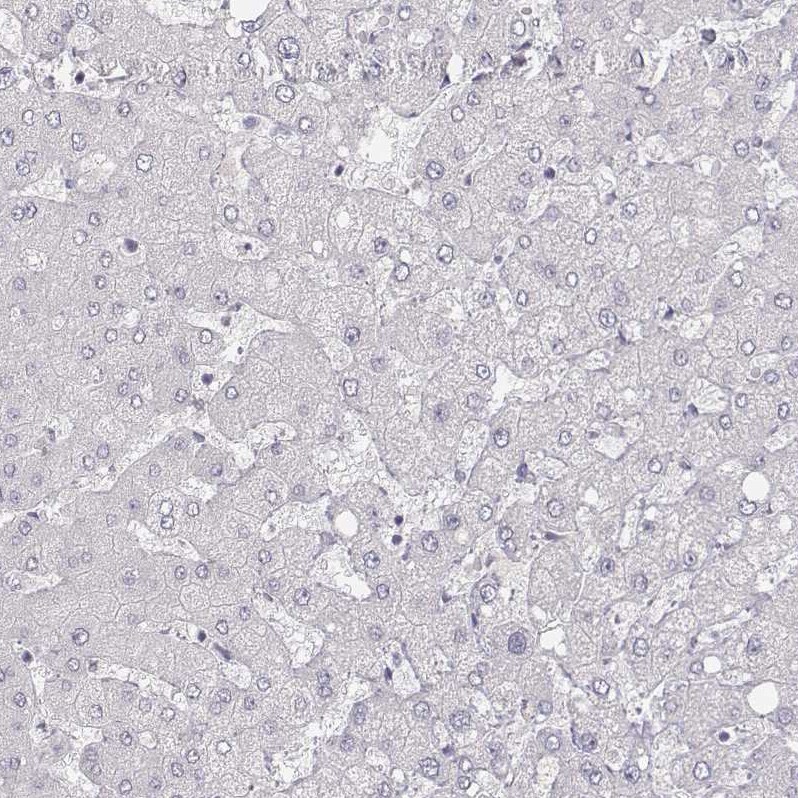 MYH6 Antibody (CL2155) - Azide and BSA Free Immunohistochemistry-Paraffin: MYH6 Antibody [NBP3-44472]