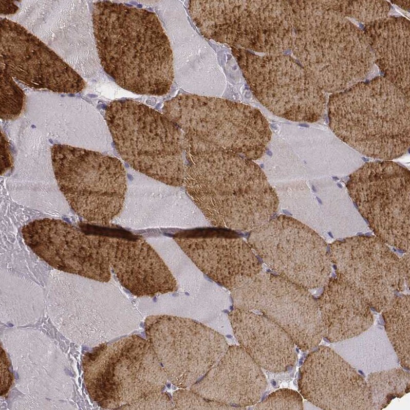 MYH6 Antibody (CL2162) - Azide and BSA Free Immunohistochemistry-Paraffin: MYH6 Antibody [NBP3-44473]