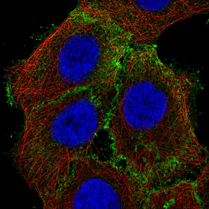 Ezrin Antibody (CL2375) - Azide and BSA Free Immunocytochemistry/ Immunofluorescence: Ezrin Antibody [NBP3-44474]