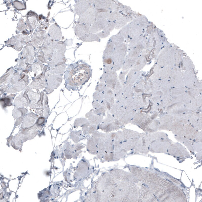 Ezrin Antibody (CL2375) - Azide and BSA Free Immunohistochemistry-Paraffin: Ezrin Antibody [NBP3-44474]
