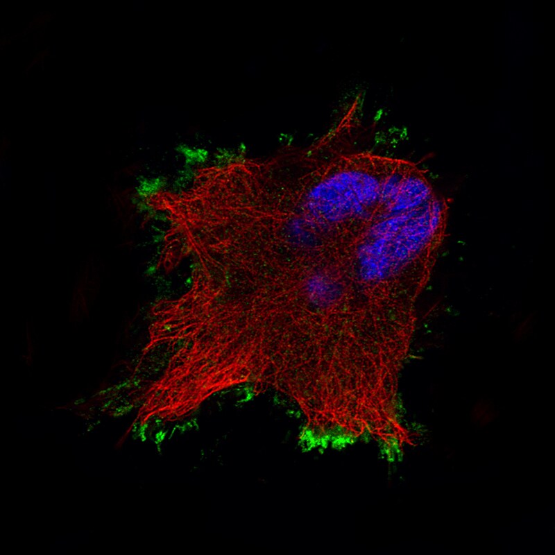 Ezrin Antibody (CL2375) - Azide and BSA Free Immunocytochemistry/ Immunofluorescence: Ezrin Antibody [NBP3-44474]