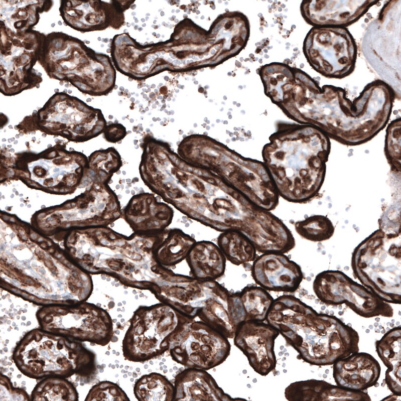Ezrin Antibody (CL2375) - Azide and BSA Free Immunohistochemistry-Paraffin: Ezrin Antibody [NBP3-44474]