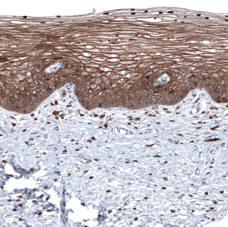 Ezrin Antibody (CL2375) - Azide and BSA Free Immunohistochemistry-Paraffin: Ezrin Antibody [NBP3-44474]