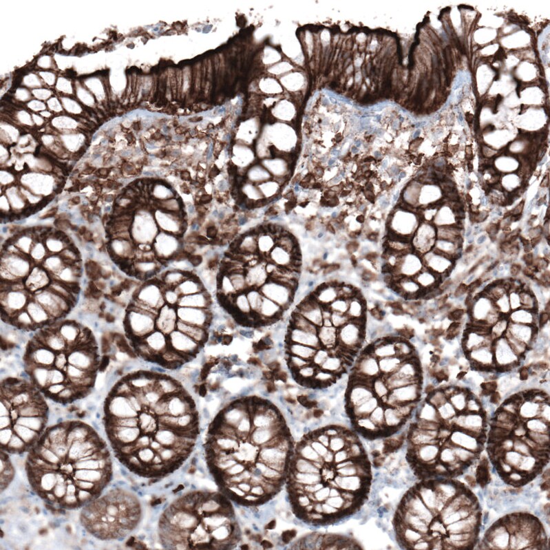 Ezrin Antibody (CL2375) - Azide and BSA Free Immunohistochemistry-Paraffin: Ezrin Antibody [NBP3-44474]