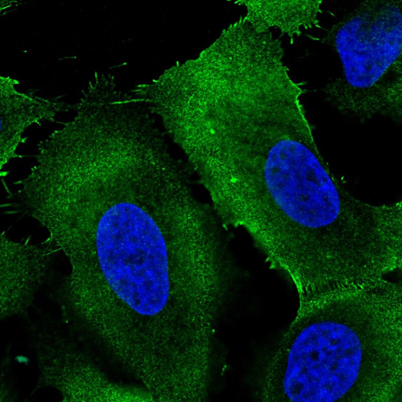 Ezrin Antibody (CL2384) - Azide and BSA Free Immunocytochemistry/ Immunofluorescence: Ezrin Antibody [NBP3-44475]