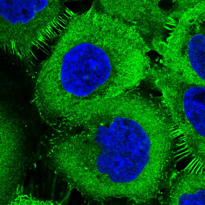 Ezrin Antibody (CL2384) - Azide and BSA Free Immunocytochemistry/ Immunofluorescence: Ezrin Antibody [NBP3-44475]