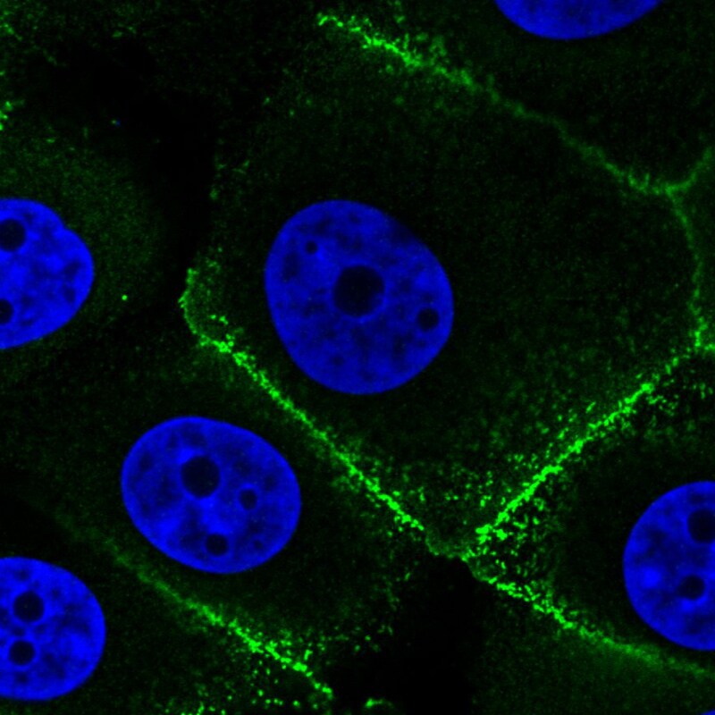 Ezrin Antibody (CL2384) - Azide and BSA Free Immunocytochemistry/ Immunofluorescence: Ezrin Antibody [NBP3-44475]