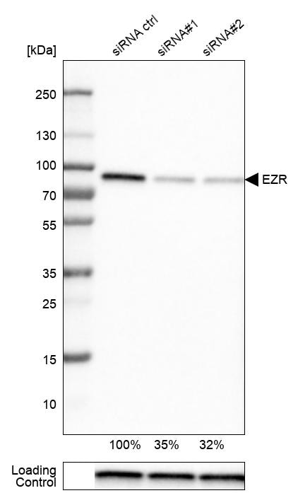 Ezrin Antibody (CL2384) - Azide and BSA Free Western Blot: Ezrin Antibody [NBP3-44475]