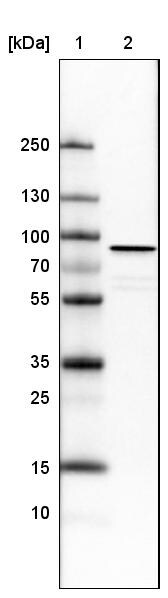 Ezrin Antibody (CL2360) - Azide and BSA Free Western Blot: Ezrin Antibody [NBP3-44476]