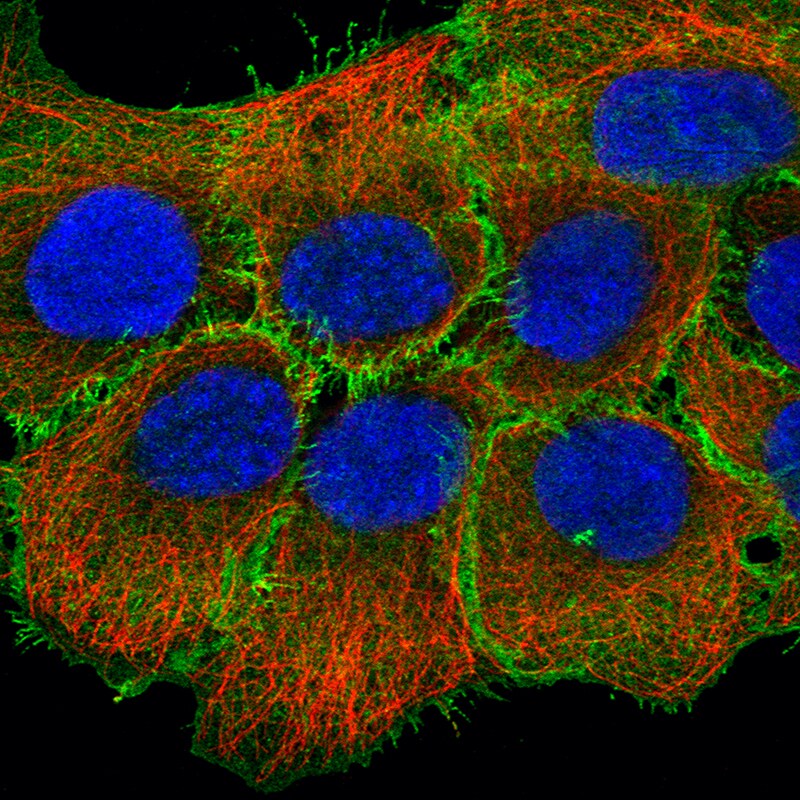 Ezrin Antibody (CL2360) - Azide and BSA Free Immunocytochemistry/ Immunofluorescence: Ezrin Antibody [NBP3-44476]