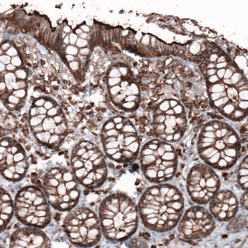 Ezrin Antibody (CL2360) - Azide and BSA Free Immunohistochemistry-Paraffin: Ezrin Antibody [NBP3-44476]