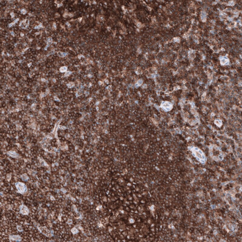 Ezrin Antibody (CL2360) - Azide and BSA Free Immunohistochemistry-Paraffin: Ezrin Antibody [NBP3-44476]