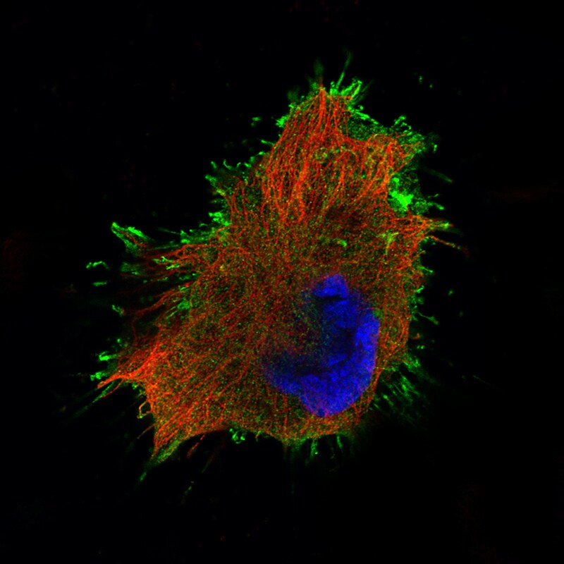 Ezrin Antibody (CL2360) - Azide and BSA Free Immunocytochemistry/ Immunofluorescence: Ezrin Antibody [NBP3-44476]