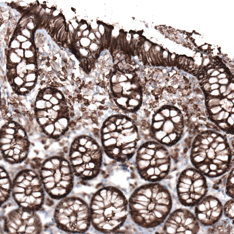 Ezrin Antibody (CL2378) - Azide and BSA Free Immunohistochemistry-Paraffin: Ezrin Antibody [NBP3-44477]