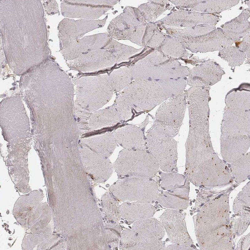 GRASP55 Antibody (CL2610) - Azide and BSA Free Immunohistochemistry-Paraffin: GRASP55 Antibody [NBP3-44478]