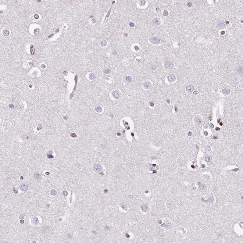 NRSF Antibody (CL0381) - Azide and BSA Free Immunohistochemistry-Paraffin: NRSF Antibody [NBP3-44479]