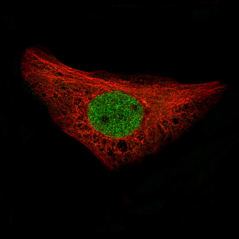 NRSF Antibody (CL0381) - Azide and BSA Free Immunocytochemistry/ Immunofluorescence: NRSF Antibody [NBP3-44479]