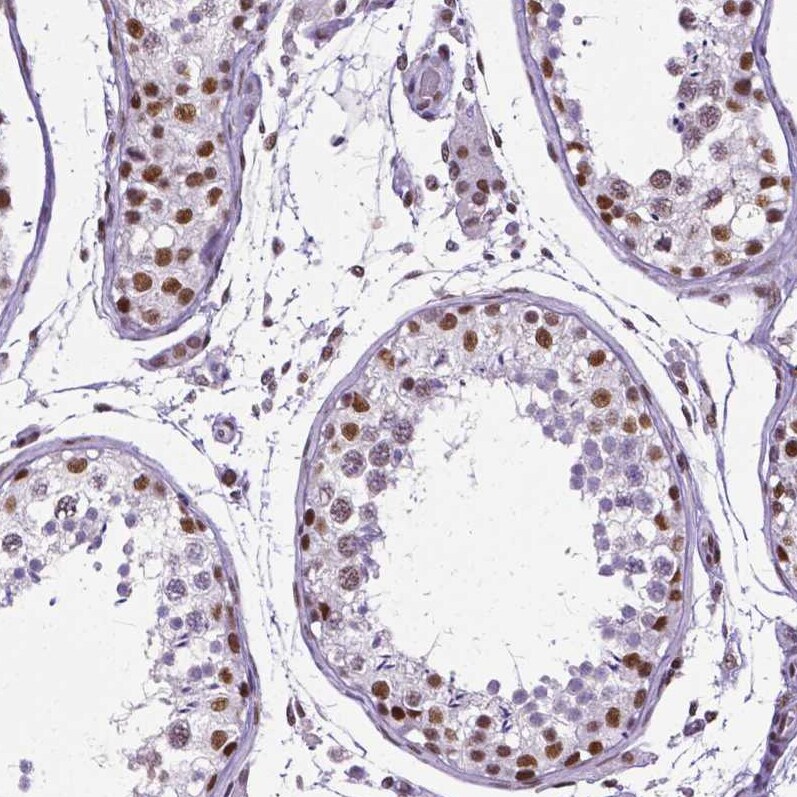NRSF Antibody (CL0381) - Azide and BSA Free Immunohistochemistry-Paraffin: NRSF Antibody [NBP3-44479]
