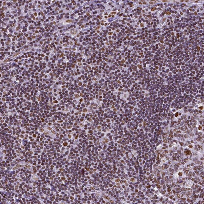 NRSF Antibody (CL0381) - Azide and BSA Free Immunohistochemistry-Paraffin: NRSF Antibody [NBP3-44479]