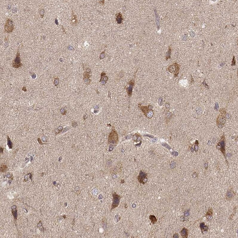 CARS Antibody (CL2302) - Azide and BSA Free Immunohistochemistry-Paraffin: CARS Antibody [NBP3-44480]