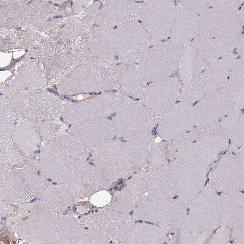 CARS Antibody (CL2302) - Azide and BSA Free Immunohistochemistry-Paraffin: CARS Antibody [NBP3-44480]