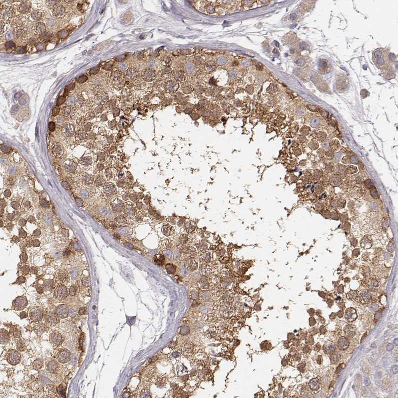 CARS Antibody (CL2302) - Azide and BSA Free Immunohistochemistry-Paraffin: CARS Antibody [NBP3-44480]