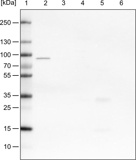 CARS Antibody (CL2304) - Azide and BSA Free Western Blot: CARS Antibody [NBP3-44481]