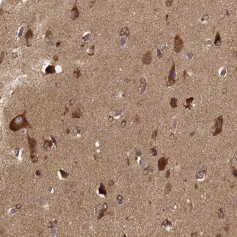 CARS Antibody (CL2304) - Azide and BSA Free Immunohistochemistry-Paraffin: CARS Antibody [NBP3-44481]