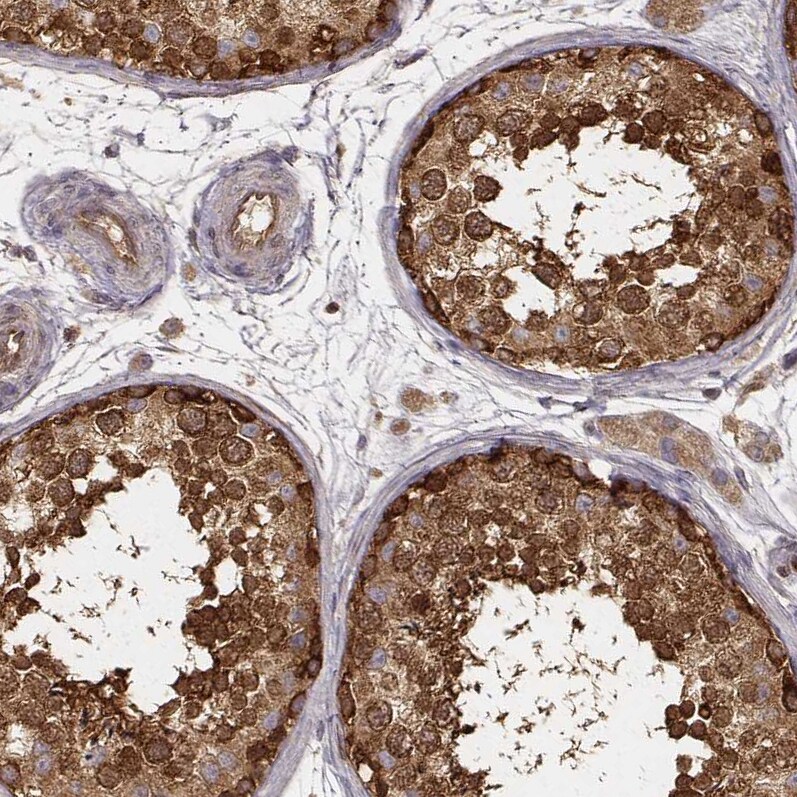 CARS Antibody (CL2304) - Azide and BSA Free Immunohistochemistry-Paraffin: CARS Antibody [NBP3-44481]