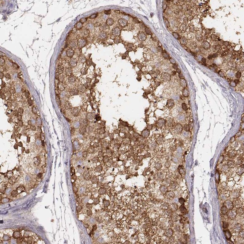 CARS Antibody (CL2309) - Azide and BSA Free Immunohistochemistry-Paraffin: CARS Antibody [NBP3-44482]