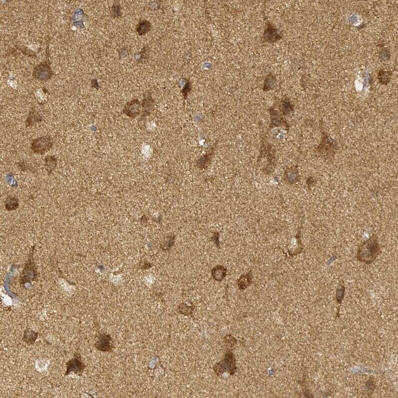 CARS Antibody (CL2310) - Azide and BSA Free Immunohistochemistry-Paraffin: CARS Antibody [NBP3-44483]