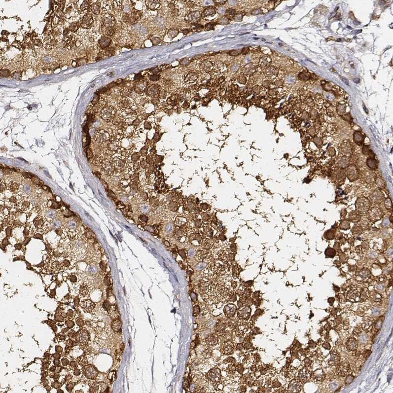 CARS Antibody (CL2310) - Azide and BSA Free Immunohistochemistry-Paraffin: CARS Antibody [NBP3-44483]
