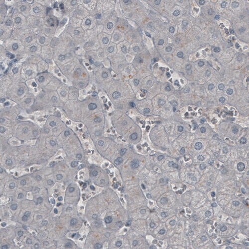 Ly6K Antibody (CL2433) - Azide and BSA Free Immunohistochemistry-Paraffin: Ly6K Antibody [NBP3-44484]