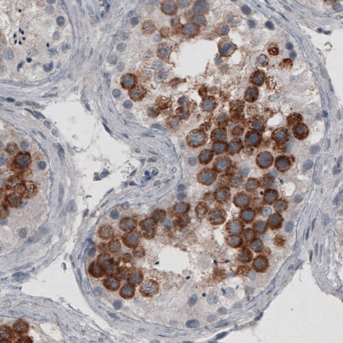 Ly6K Antibody (CL2433) - Azide and BSA Free Immunohistochemistry-Paraffin: Ly6K Antibody [NBP3-44484]