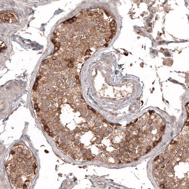 ATG5 Antibody (CL9508) - Azide and BSA Free Immunohistochemistry-Paraffin: ATG5 Antibody [NBP3-44486]