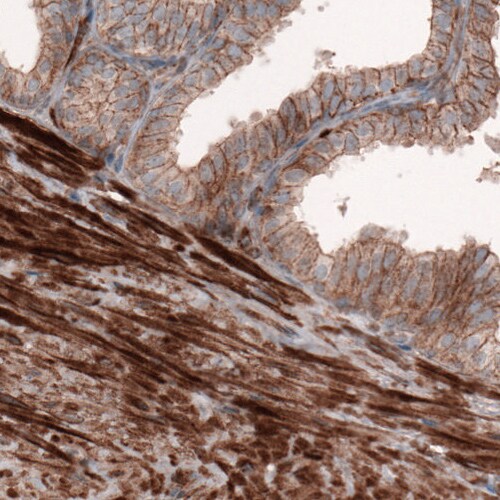 beta-Actin Antibody (CL3868) - Azide and BSA Free Immunohistochemistry-Paraffin: beta-Actin Antibody [NBP3-44487]