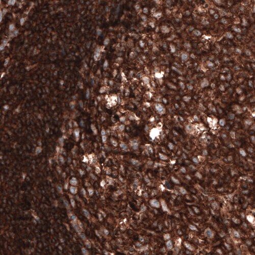 beta-Actin Antibody (CL3868) - Azide and BSA Free Immunohistochemistry-Paraffin: beta-Actin Antibody [NBP3-44487]