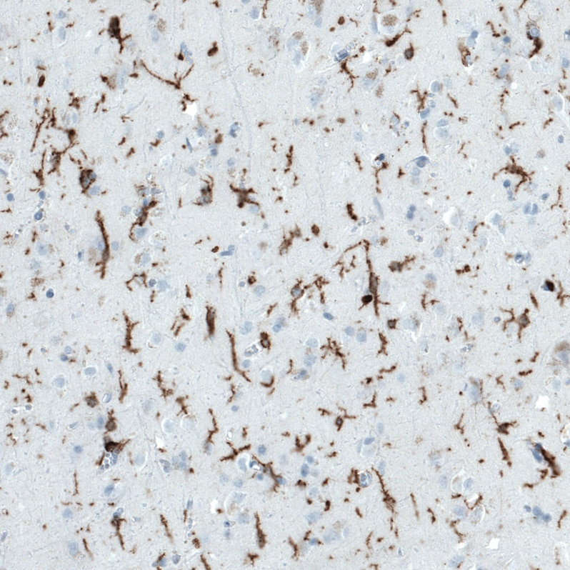 CD45 Antibody (CL0159) - Azide and BSA Free Immunohistochemistry-Paraffin: CD45 Antibody [NBP3-44488]