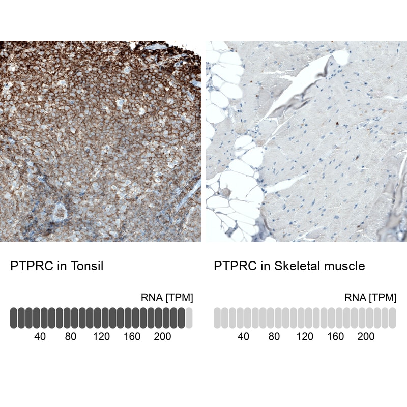 CD45 Antibody (CL0159) - Azide and BSA Free Immunohistochemistry-Paraffin: CD45 Antibody [NBP3-44488]