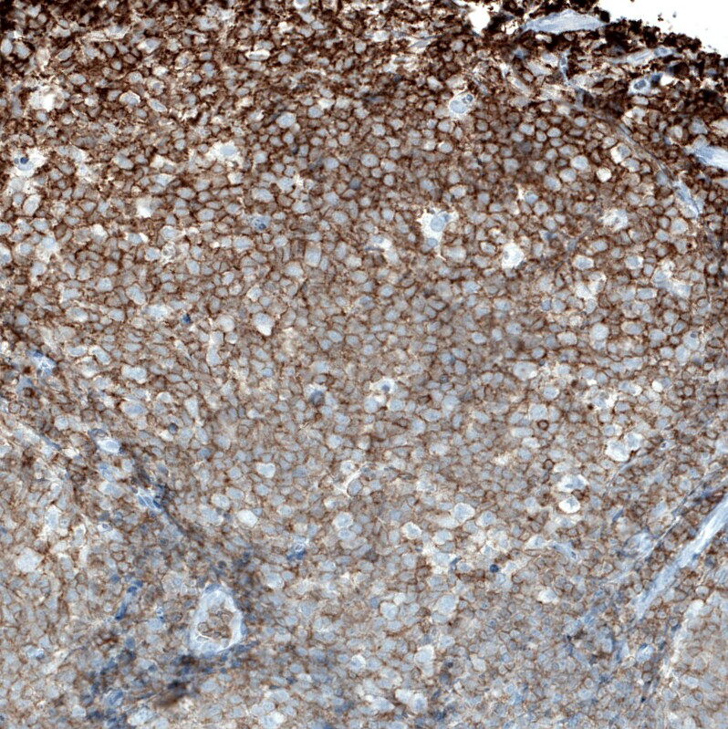 CD45 Antibody (CL0159) - Azide and BSA Free Immunohistochemistry-Paraffin: CD45 Antibody [NBP3-44488]