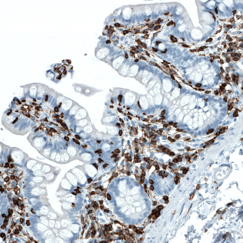 CD45 Antibody (CL0159) - Azide and BSA Free Immunohistochemistry-Paraffin: CD45 Antibody [NBP3-44488]