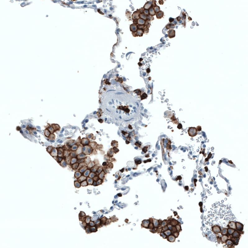 CD45 Antibody (CL0159) - Azide and BSA Free Immunohistochemistry-Paraffin: CD45 Antibody [NBP3-44488]