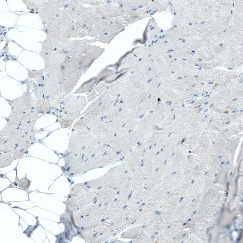CD45 Antibody (CL0159) - Azide and BSA Free Immunohistochemistry-Paraffin: CD45 Antibody [NBP3-44488]