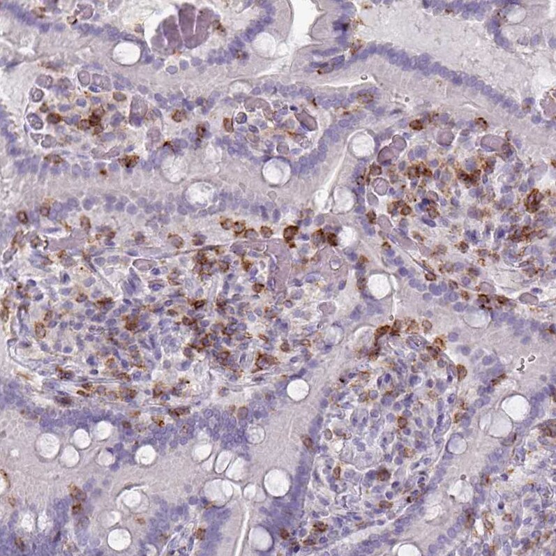 CD45 Antibody (CL0160) - Azide and BSA Free Immunohistochemistry-Paraffin: CD45 Antibody [NBP3-44489]
