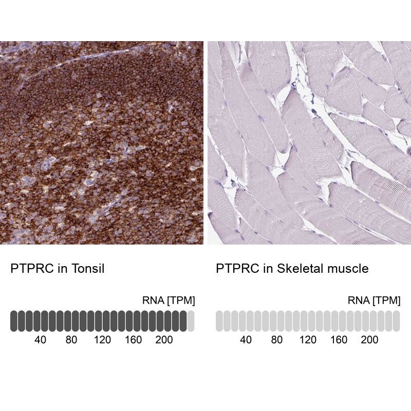 CD45 Antibody (CL0160) - Azide and BSA Free Immunohistochemistry-Paraffin: CD45 Antibody [NBP3-44489]