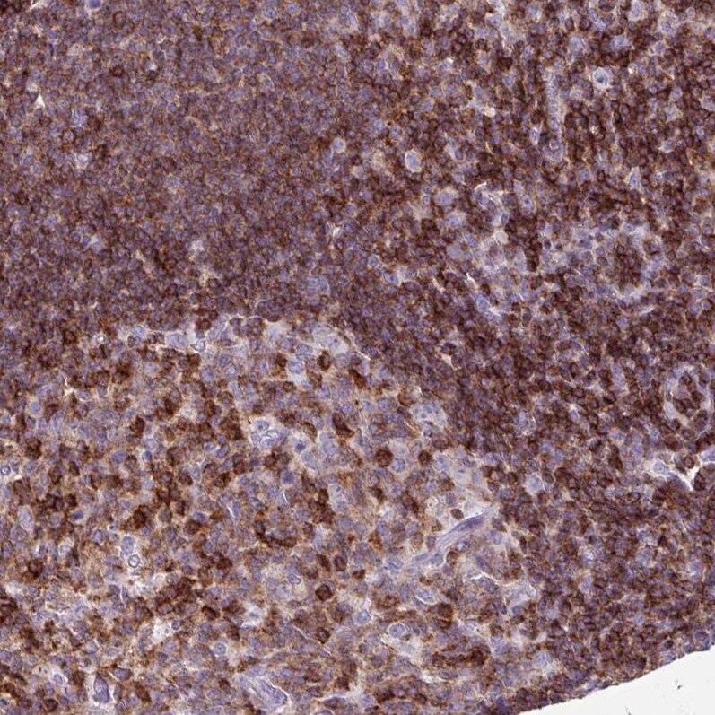 CD45 Antibody (CL0160) - Azide and BSA Free Immunohistochemistry-Paraffin: CD45 Antibody [NBP3-44489]